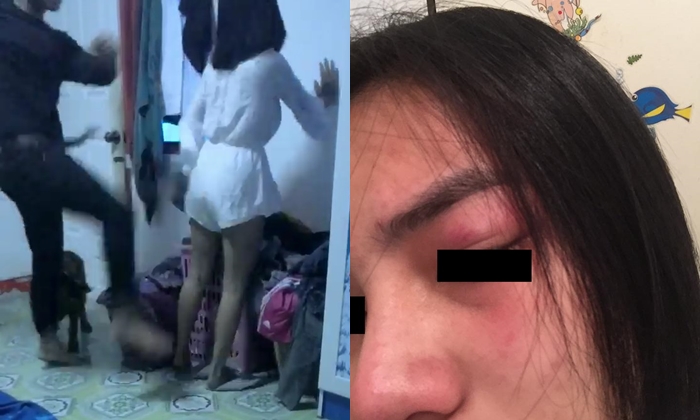 สาวสุดช้ำ! โดนแฟน "ซ้อม" ร่วมครึ่งเดือน ได้โอกาสอัดคลิปแฉ ลั่น "รักไปได้ไงคนแบบนี้"