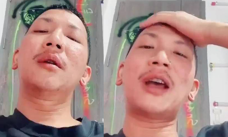 \