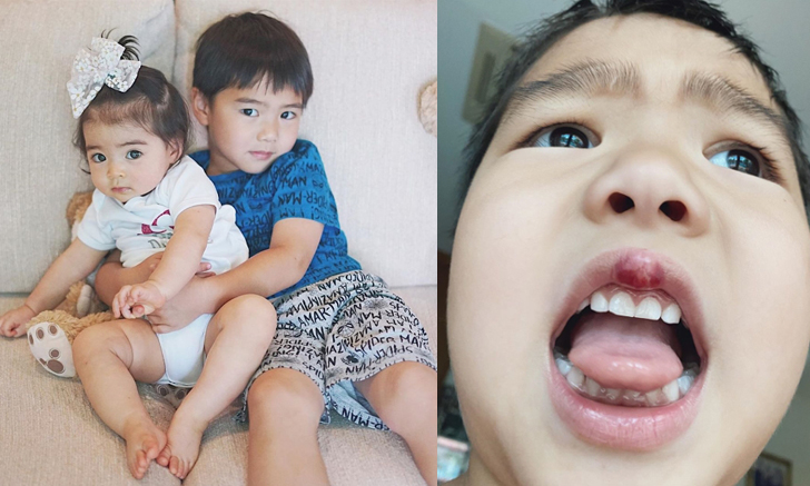 เจ็บจี๊ด "น้องดีแลน" สะดุดขาตัวเองล้ม ปากบวม แดง แฟนๆ ทั้งสงสารทั้งเอ็นดู