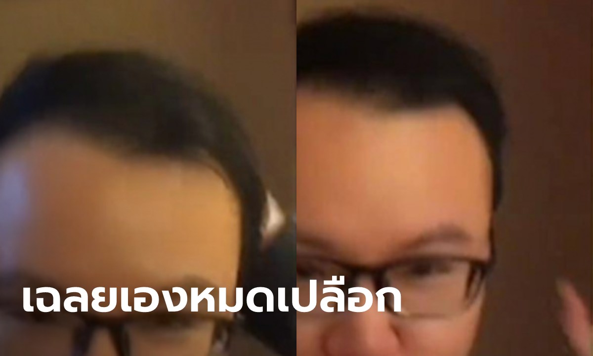 อดีตหนุ่มผมบาง เผยเคล็ดลับผมดกดำ ไม่ใช่แค่ "งดสระผมครึ่งปี" อย่างที่ลือกัน!!
