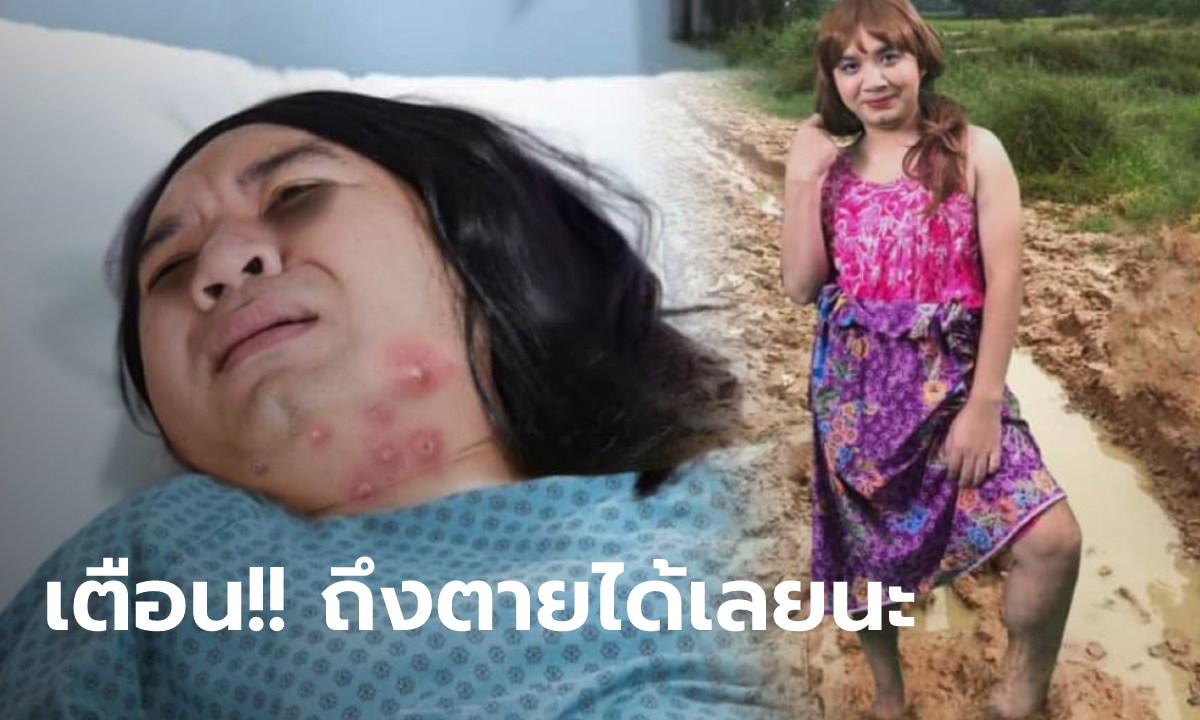 หมอแล็บฯ เตือนเดินย่ำน้ำย่ำโคลน เสี่ยงโรค "เมลิออยด์" เรื่องใกล้ตัวอันตรายถึงชีวิต