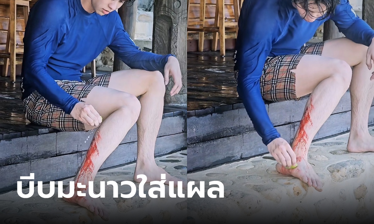 พระเอกดังเกิดอุบัติเหตุเลือดอาบ บีบมะนาวใส่แผล เห็นแล้วแสบ เฉลยสรรพคุณสุดทึ่ง