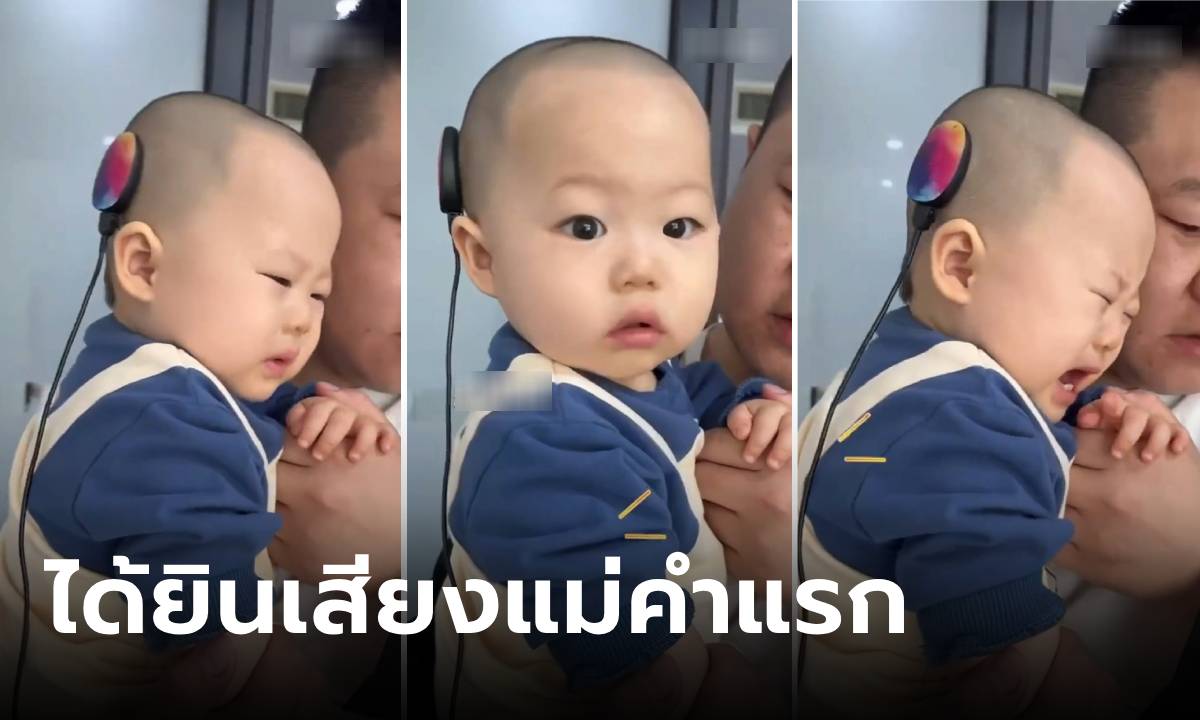 คลิป หนูน้อยหูหนวก ได้ยินเสียงแม่เรียกด้วย \