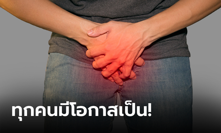 ฝันร้ายของหนุ่มๆ! นักวิจัยเผยพบ "สิ่งนี้" ในอวัยวะเพศชาย คาดอาจเป็นสาเหตุทำเซ็กซ์เสื่อม