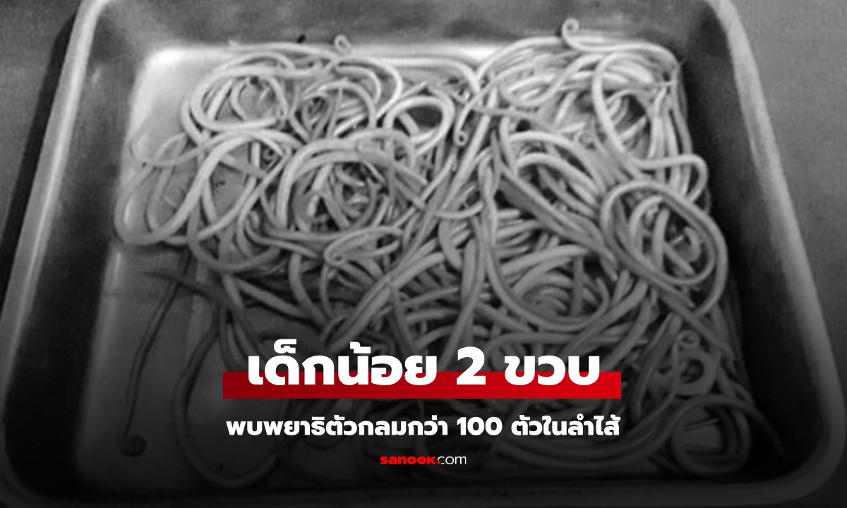 หมอตะลึง พบ \