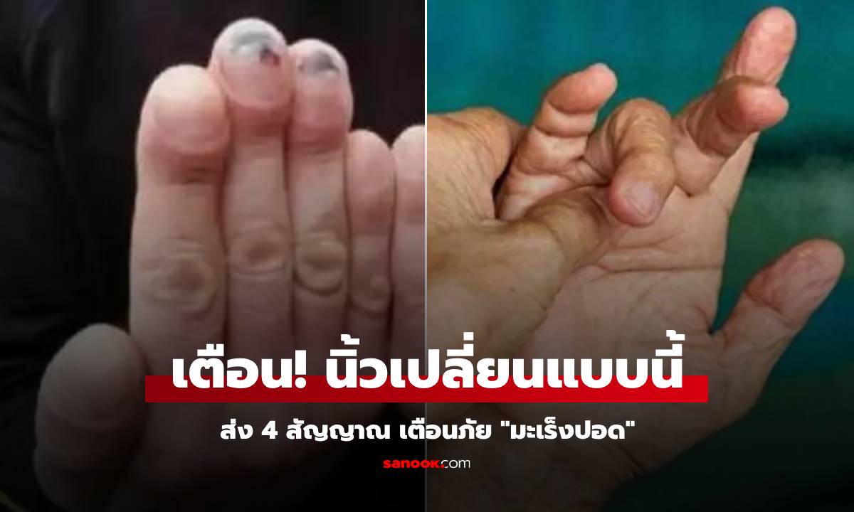 รู้ไว้ดีกว่า 4 ความเปลี่ยนแปลงที่ \