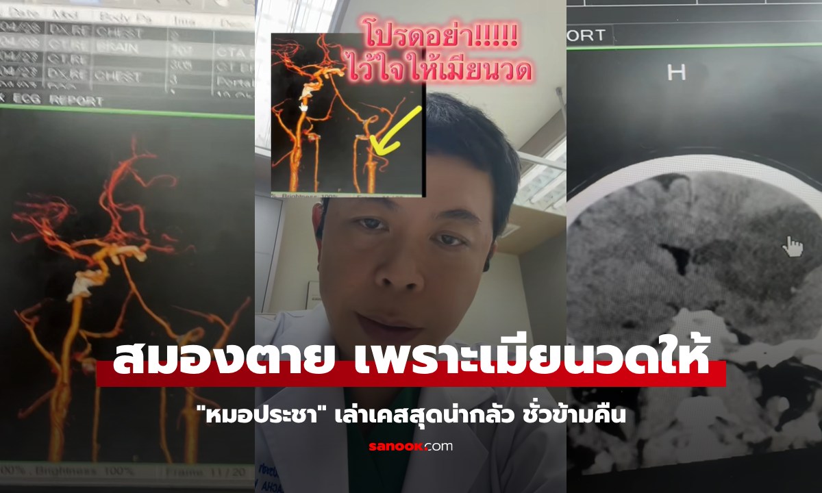 หมอประชา เล่าเคสสามี \