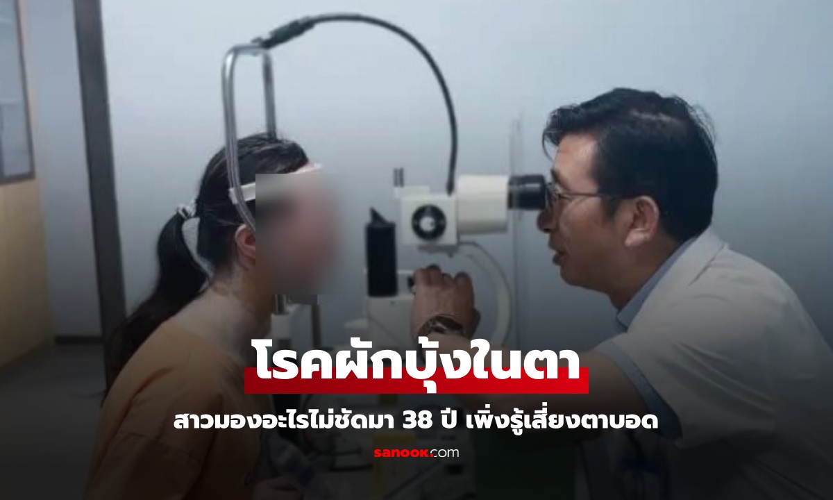 สาวมองอะไรไม่ชัดมา 38 ปี จักษุแพทย์ตรวจเจอ "โรคผักบุ้ง" ร้ายแรงเสี่ยงตาบอด