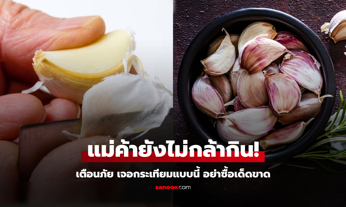 เตือนแล้วนะ กระเทียม 5 แบบ \