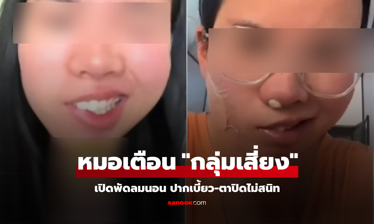เปิดพัดลมนอนกลางวัน สาวตื่นมาหน้าเบี้ยว แพทย์เตือน \