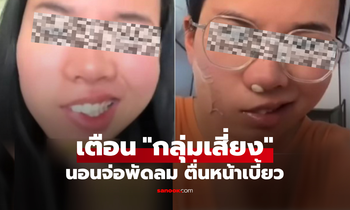 เปิดพัดลมนอนกลางวัน สาวตื่นมาหน้าเบี้ยว แพทย์เตือน \