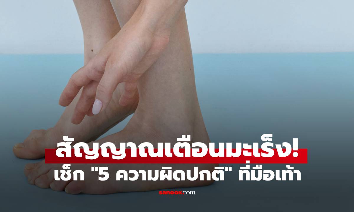 เช็ก \