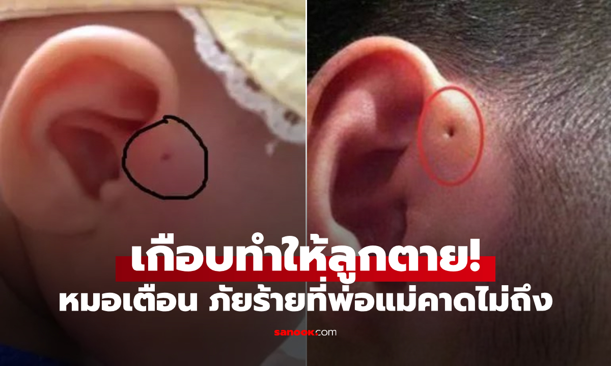 เด็กอนุบาลเกือบตาย! แม่บีบ \