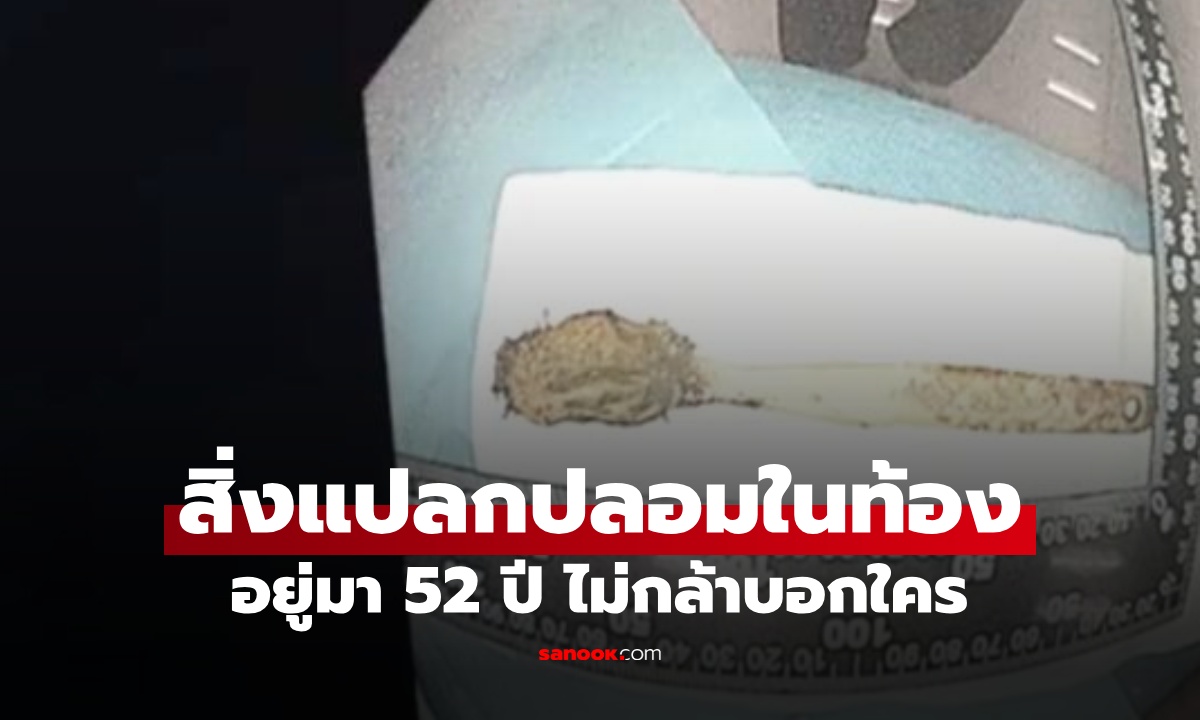 ชายชราเจ็บหน้าอกเรื้อรัง หมออึ้งต้นเหตุ \