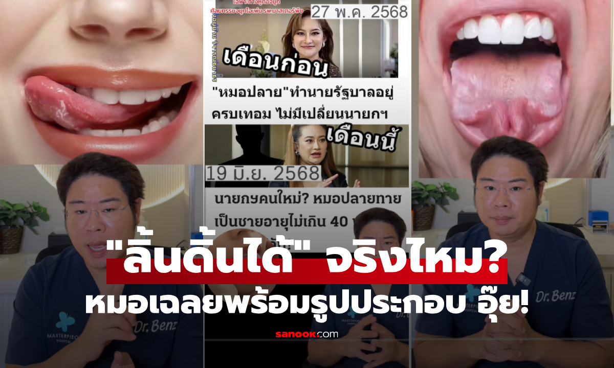 ร้องอุ๊ย! แพทย์เฉลย "ลิ้นดิ้นได้" เรื่องจริงหรือแค่สำนวน แต่คนหลุดโฟกัสรูป "หมอดูคนดัง"