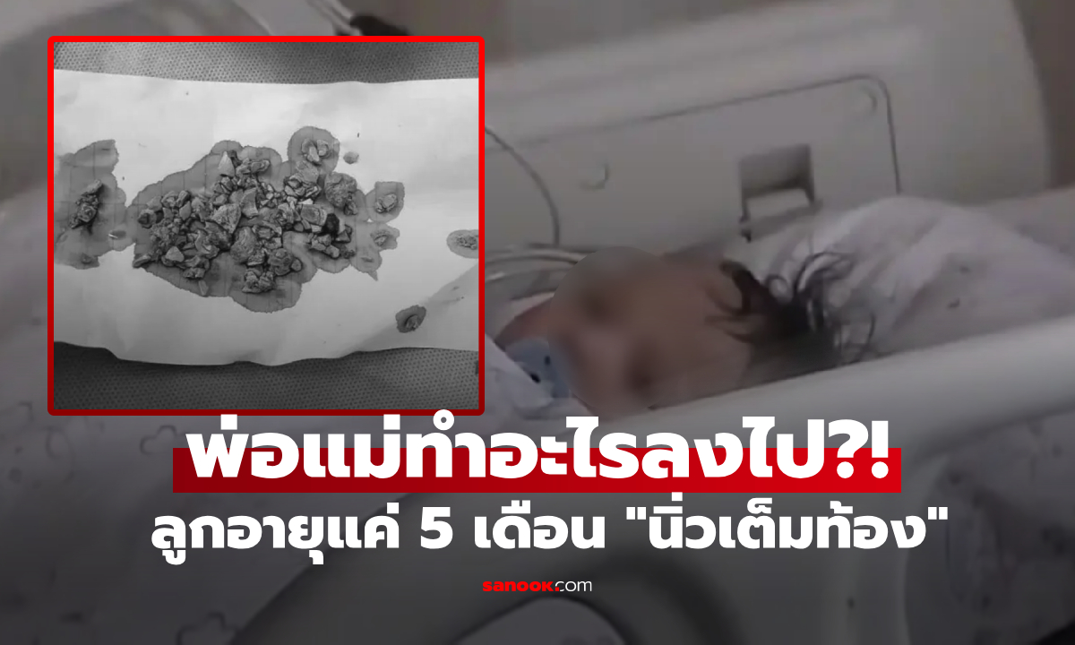 สลด ทารกวัย 5 เดือน \