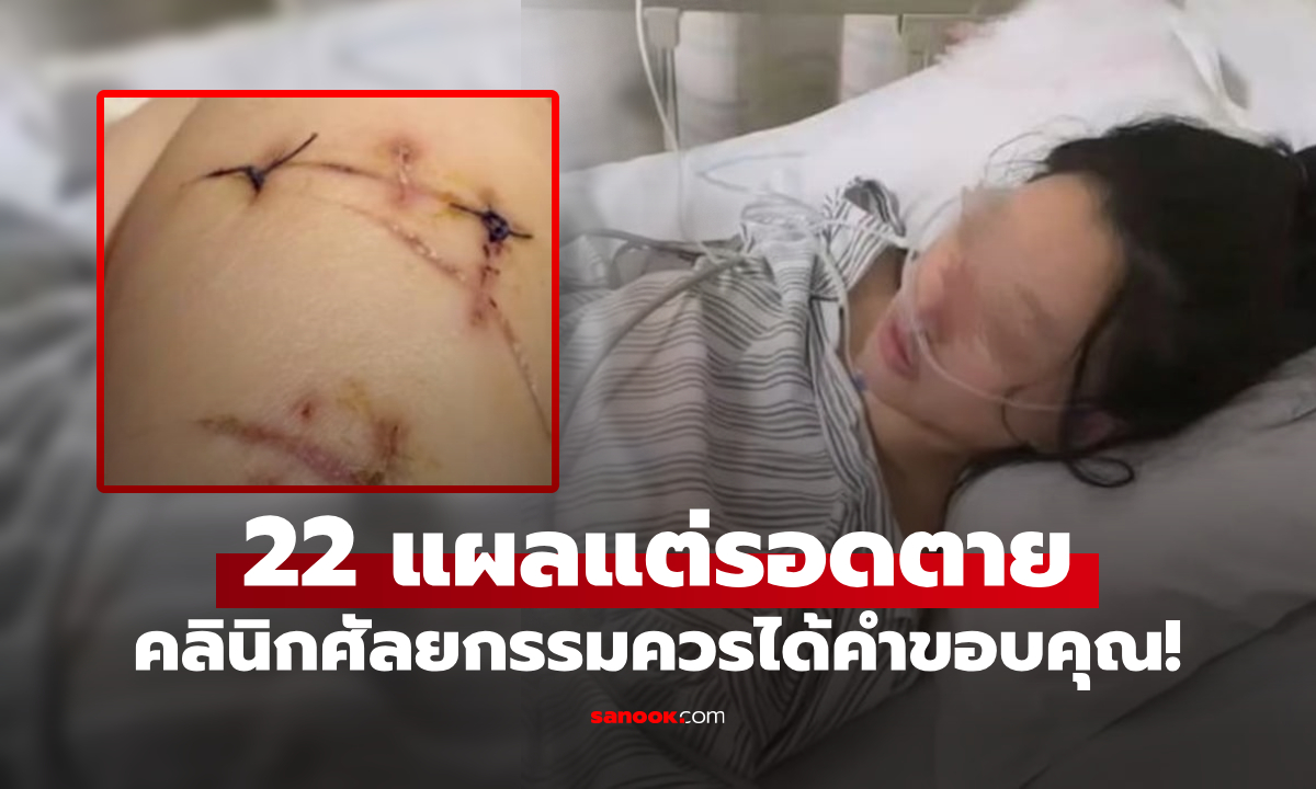 สาวจีนไปห้างฯ โจรดักแทง 22 แผล รอดตายอัศจรรย์ หมออึ้ง “ศัลยกรรม” ช่วยชีวิตของแท้!!!