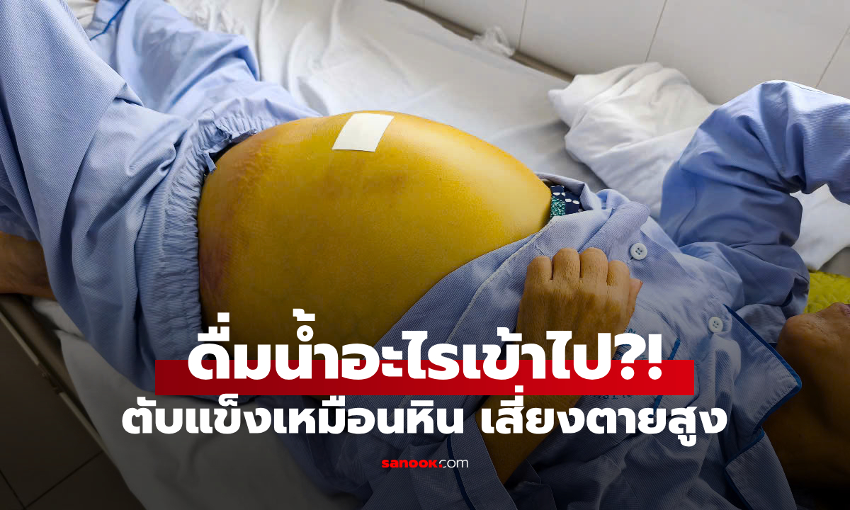 ไม่ใช่เหล้า! หญิงนอนตัวเหลือง \