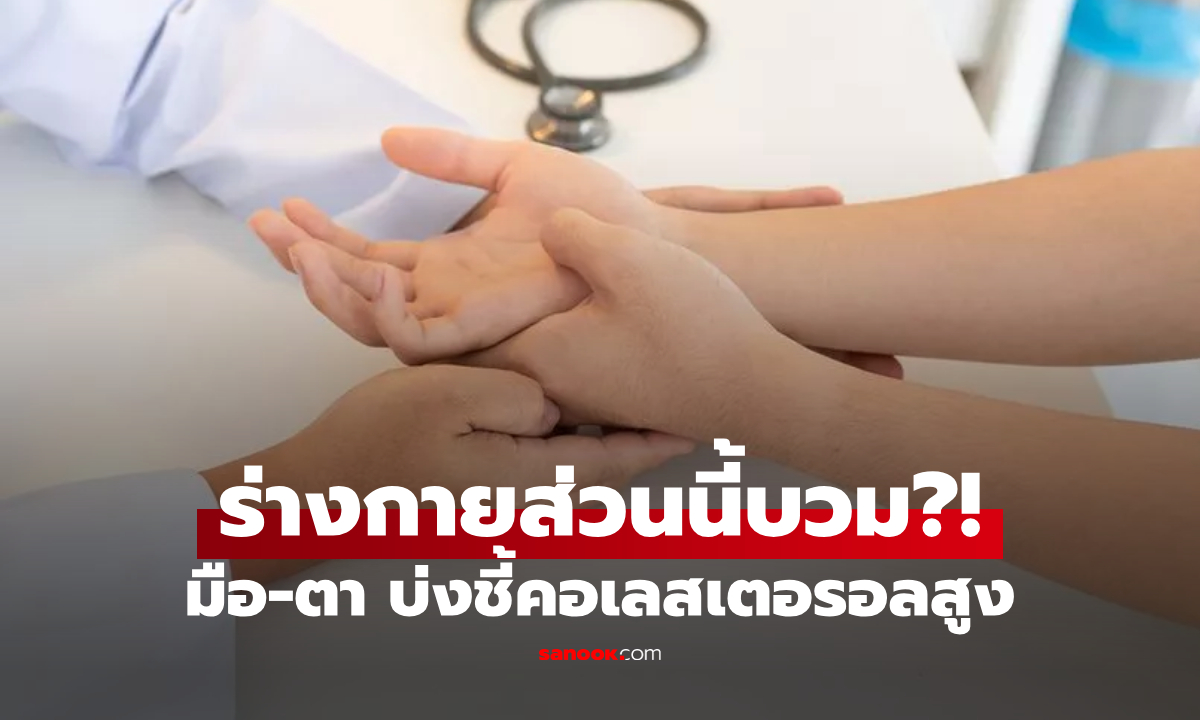 เช็กสัญญาณที่ \