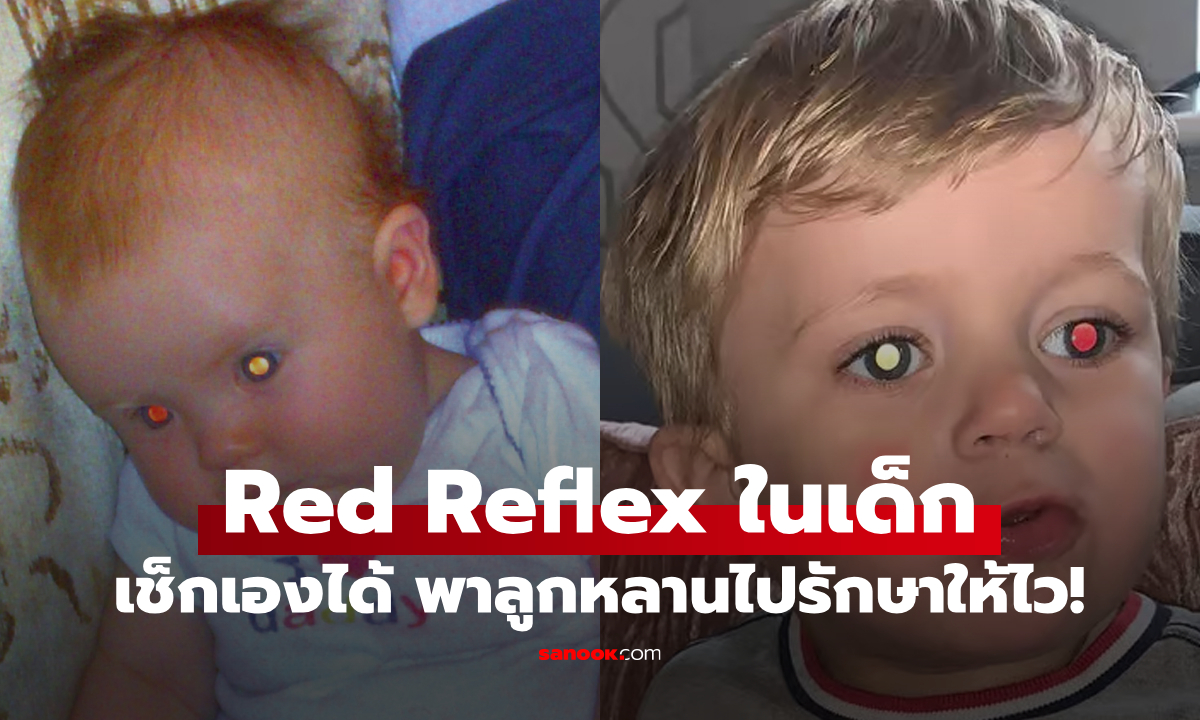 ทดสอบอาการ \
