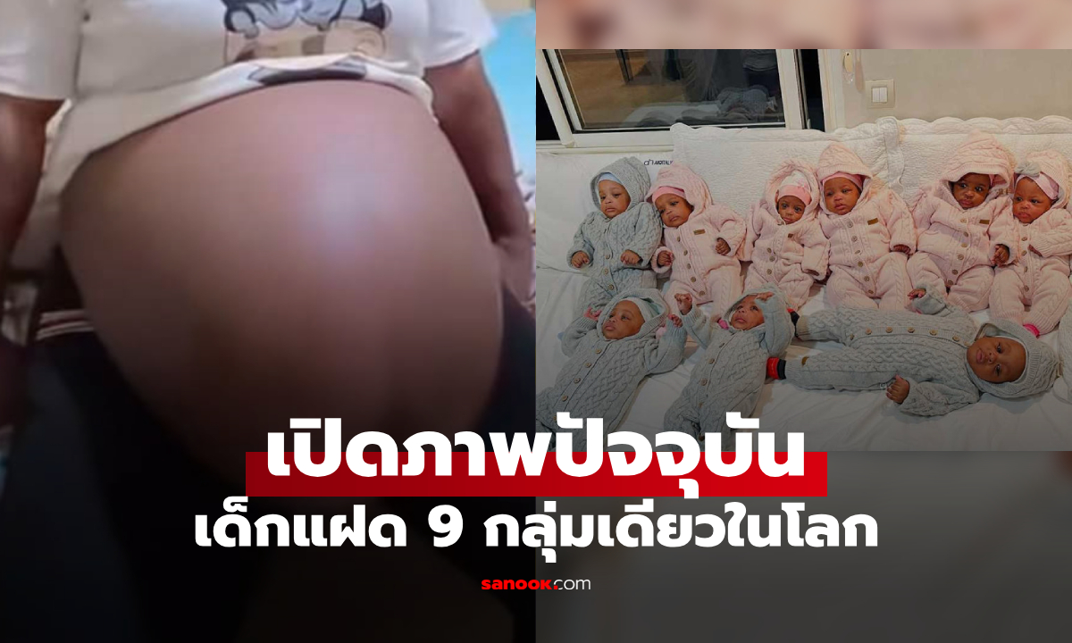 จำได้ไหม? ทารกแฝด 9 \