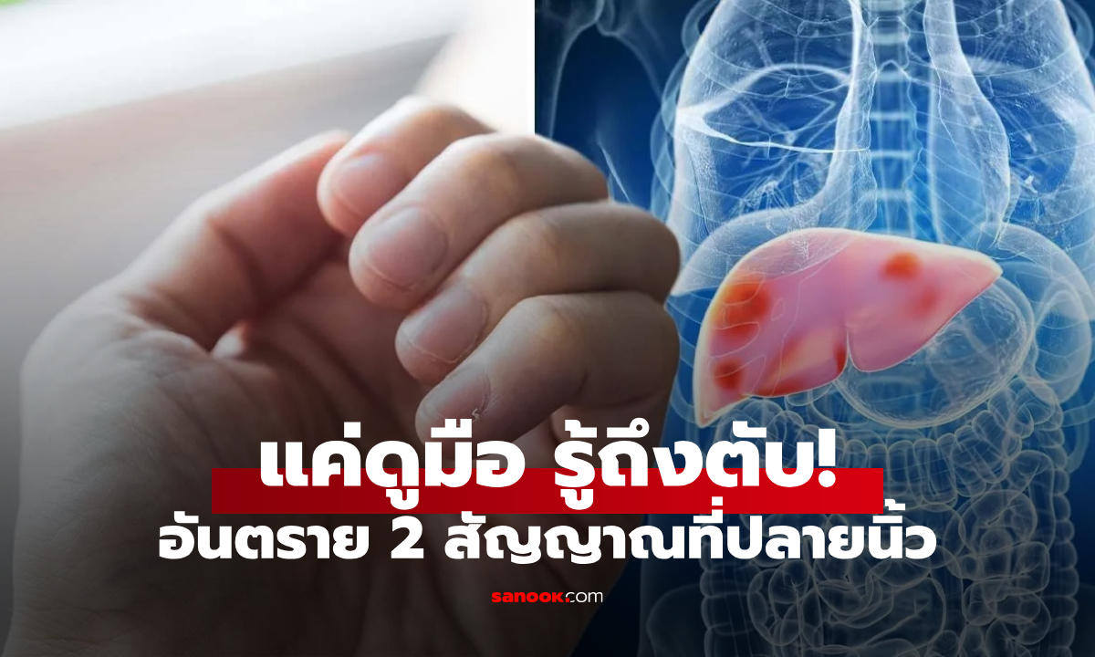 แค่ดูมือบอกถึงตับ! หากเห็นสัญญาณ 2 อย่างนี้ที่ \