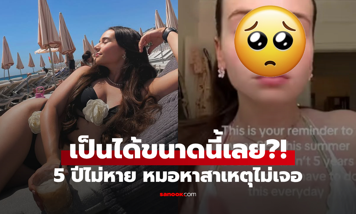 แดดเผาได้ขนาดนี้?! สาวเครียด \