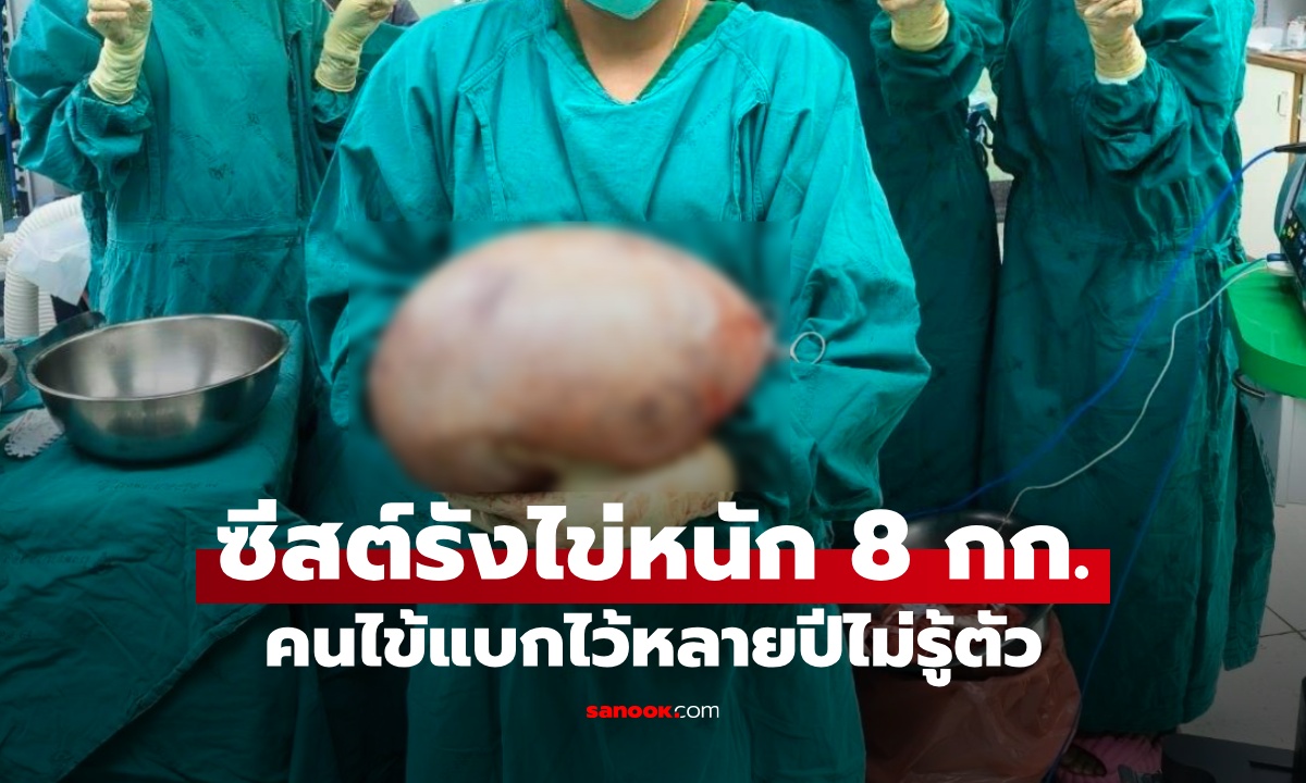 หมอพยาบาลอึ้ง ผ่าซีสต์รังไข่หนัก 8 กิโลกรัม คนไข้แบกก้อนยักษ์อยู่หลายปีไม่รู้ตัว