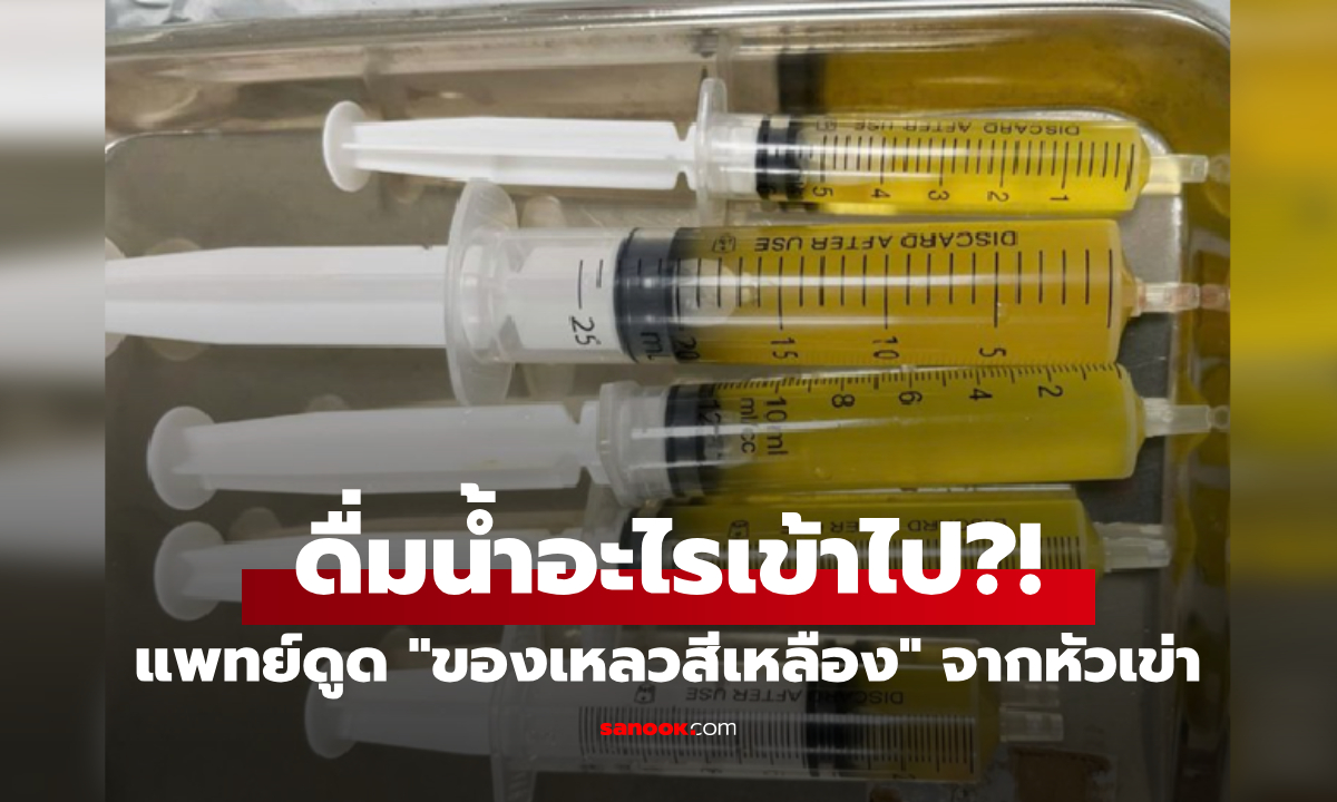 ช็อก! ชายถูกดูด \