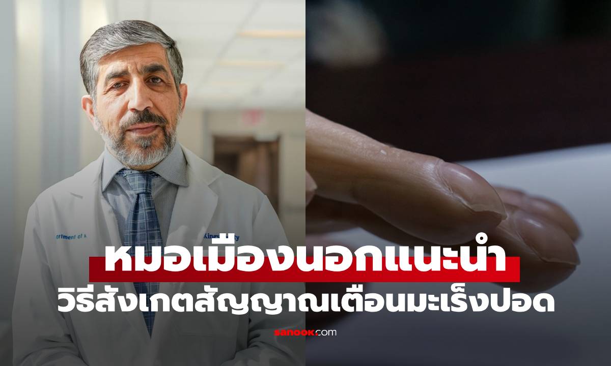 หมอเมืองนอกแนะ ให้สังเกตที่ "เล็บ" อาจเป็นสัญญาณเตือน "มะเร็งปอดระยะลุกลาม"