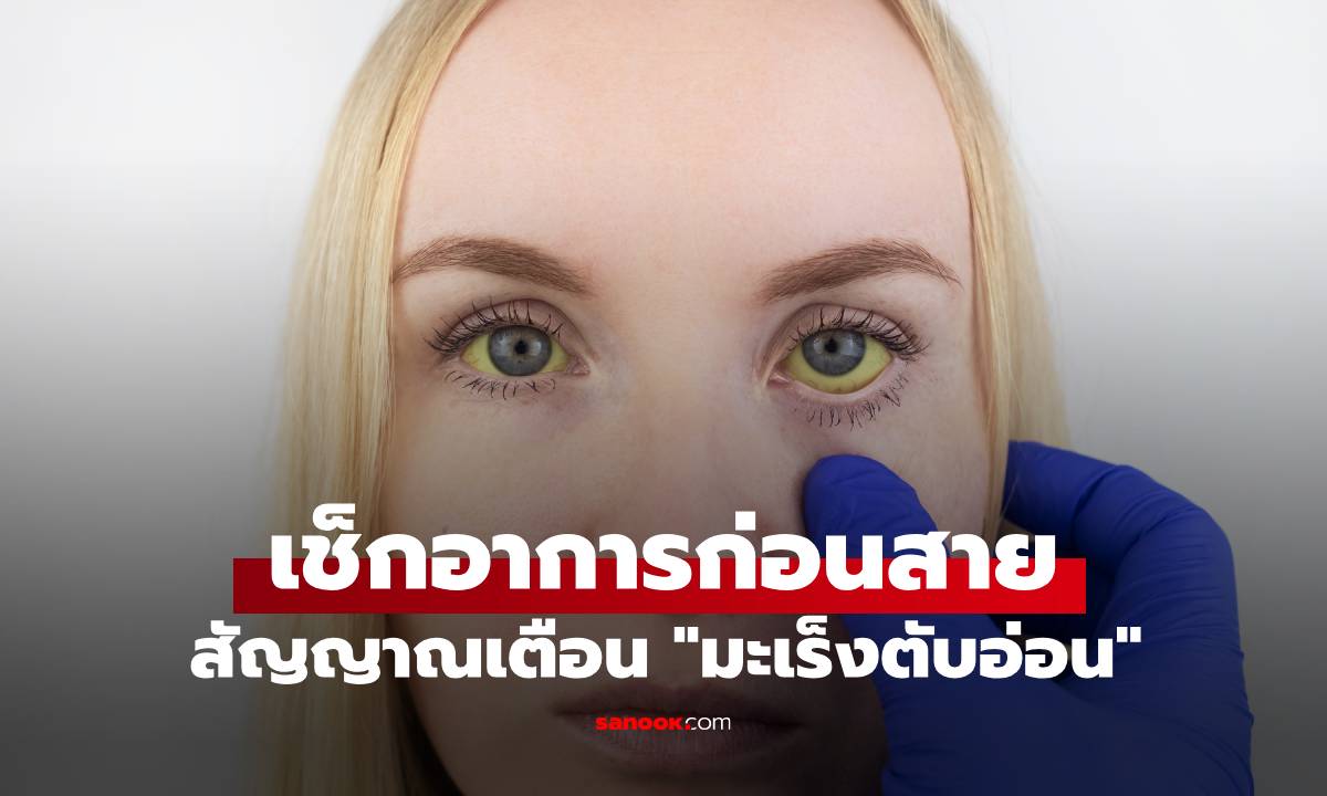 หมอเมืองนอกเผย สัญญาณที่มองเห็นได้ของ \