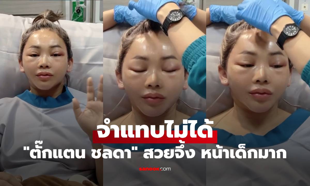 จำแทบไม่ได้ \