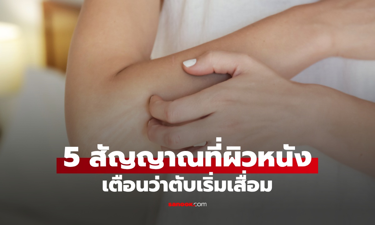 5 สัญญาณบนผิวหนัง เตือนว่า \