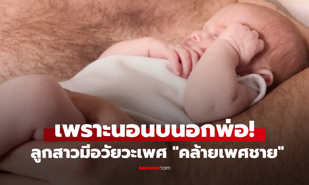 ช็อกทารกหญิง มีอวัยวะเพศคล้ายชาย หลังนอน \