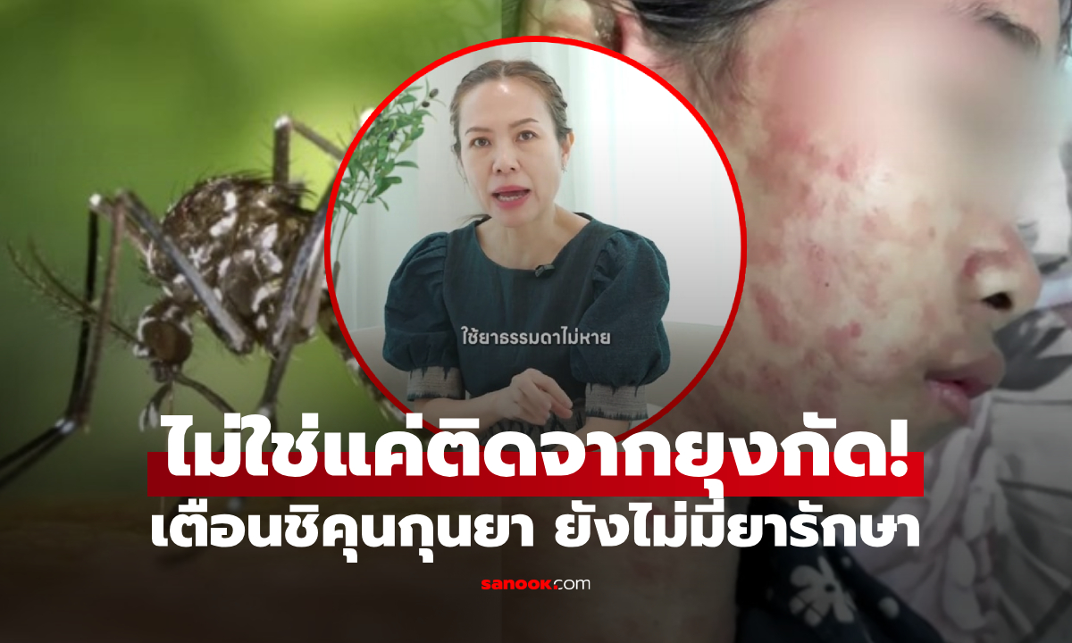 ไม่ใช่แค่ยุงกัด! หมอเตือน “ชิคุนกุนยา” ติดต่อทางใดได้บ้าง ต่างจากไข้เลือดออกไหม?