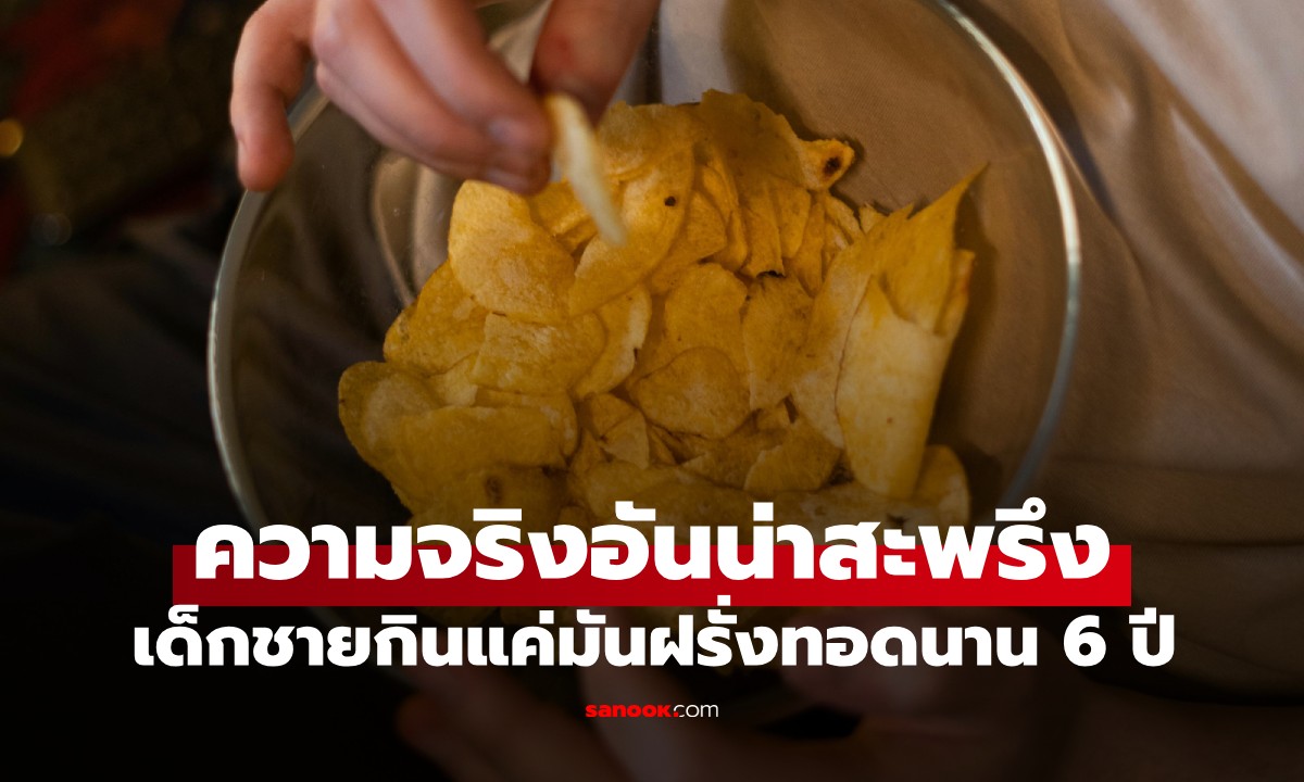 บทเรียนราคาแพง! เด็กชายกินแค่มันฝรั่งทอดนาน 6 ปี โดยแทบไม่แตะผักผลไม้เลย