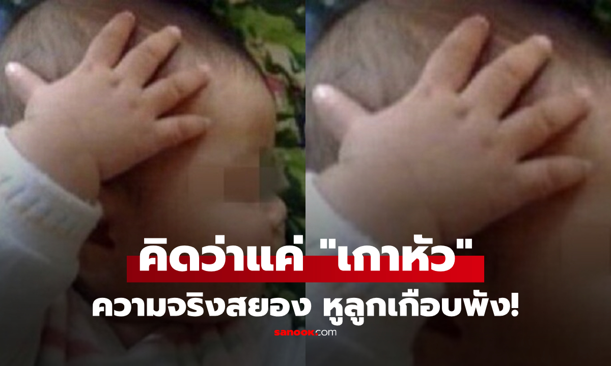 ลูกชาย 1 ขวบ เกาหัวบ่อยๆ พ่อแม่คิดว่าแค่เล่น สุดท้ายรู้ความจริงสยอง เกือบเสียการได้ยิน!