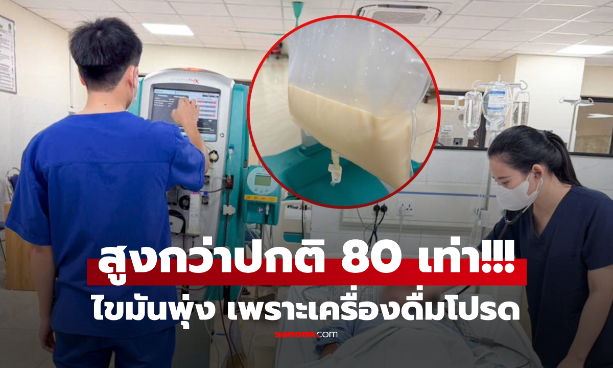 พิษเครื่องดื่มโปรด ชายไขมันในเลือดพุ่ง \