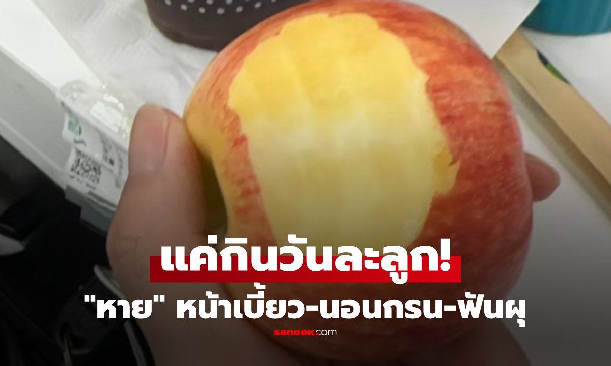 หมอแชร์เคสทึ่ง แค่กิน \