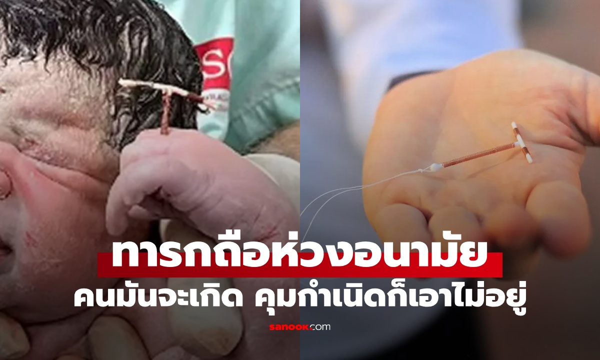 ทารกคลอดพร้อม \