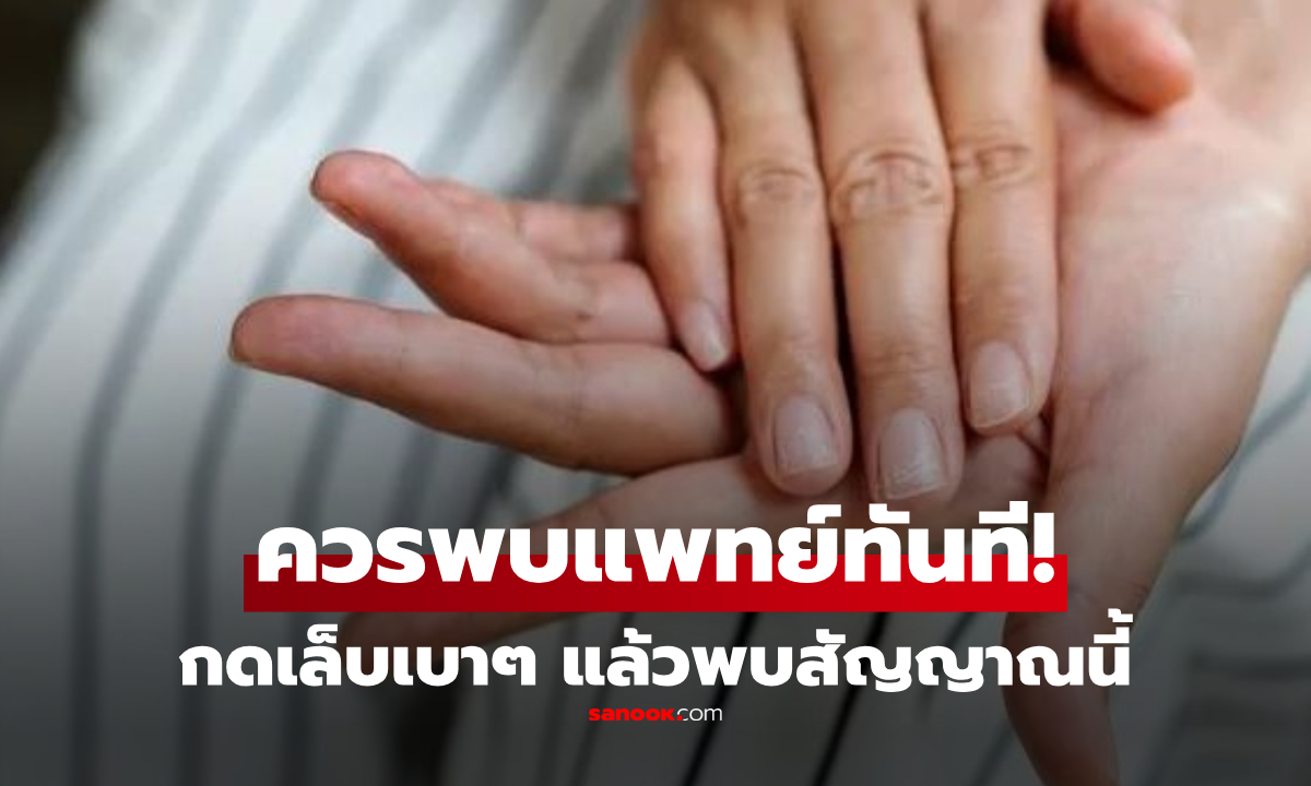 หมอเตือนเอง \