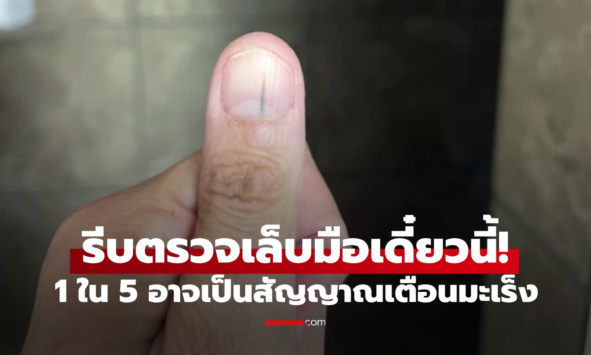 5 สัญญาณมะเร็งร้าย ที่ \