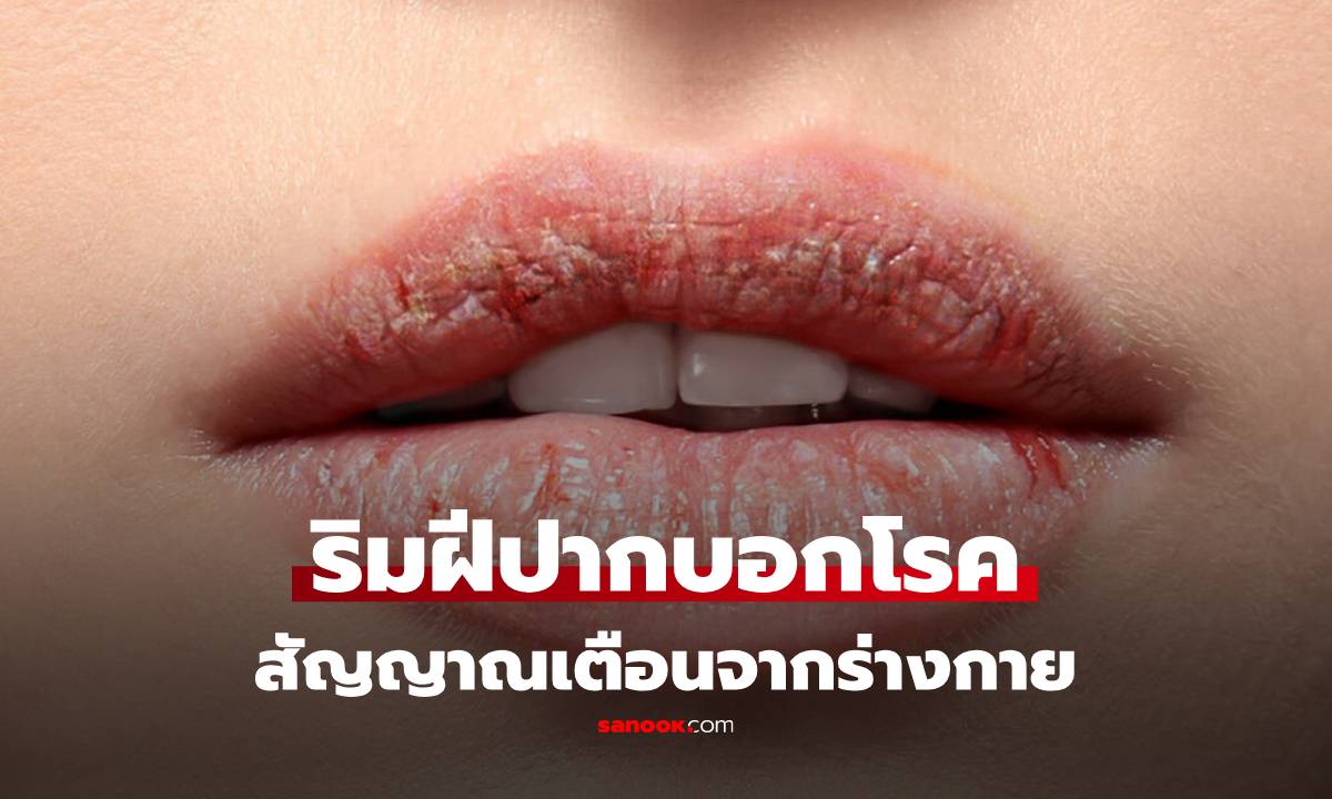 เช็กเองง่ายๆ \