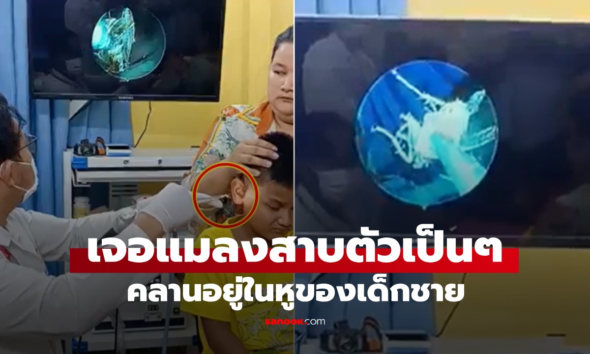 ลูกชายบ่นปวดหู แม่อึ้ง! หมออึ้ง! เจอ \