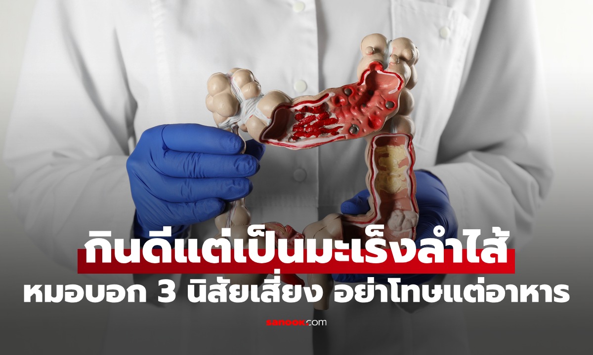 ชายกินดี กลับตายเพราะมะเร็งลำไส้ หมอเผย 3 นิสัยเสี่ยงโรค อย่าโทษแต่อาหาร