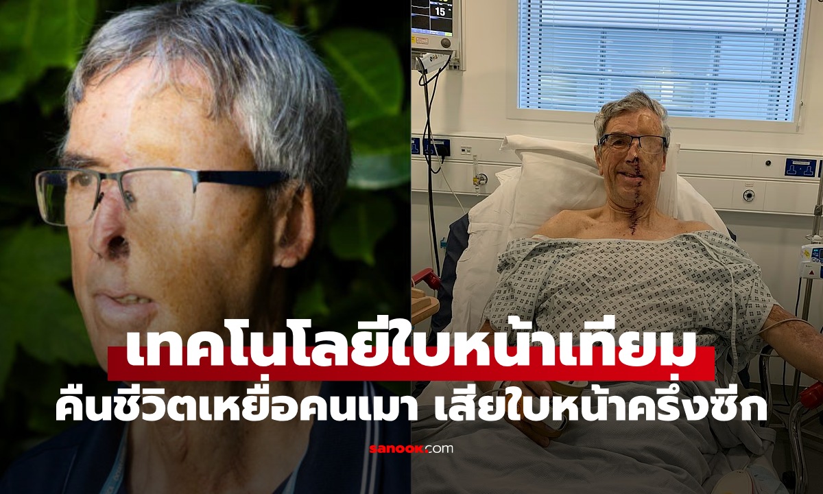 สุดทึ่งเทคโนโลยี \