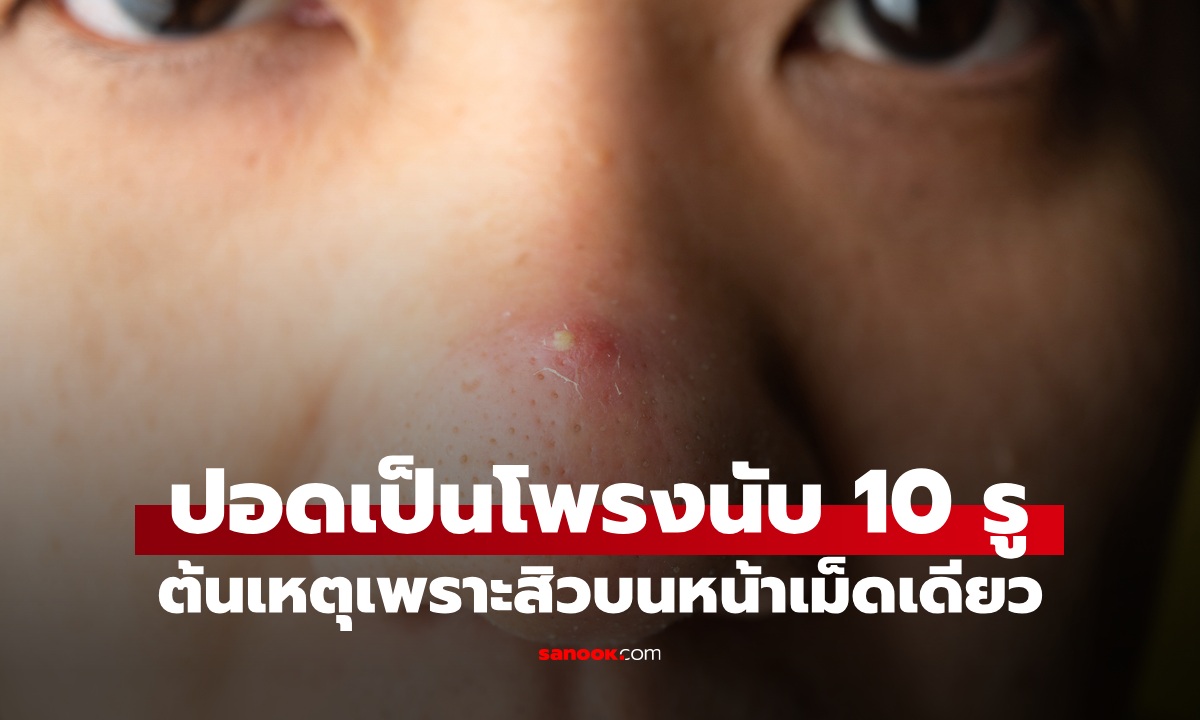 หนุ่มปอดมีโพรง มากกว่า 10 รู ไม่อยากจะเชื่อต้นเหตุเพราะ \