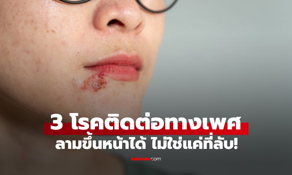 ไม่ได้มีแค่ที่ลับ! หมอเตือน \