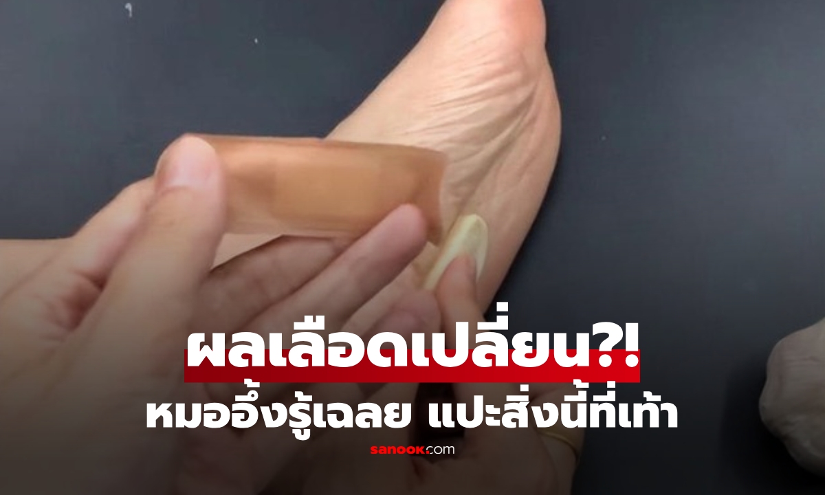 หมอถึงกับงง! หญิงวัย 56 ค่าเลือดเปลี่ยน เฉลยเคล็ดลับ \