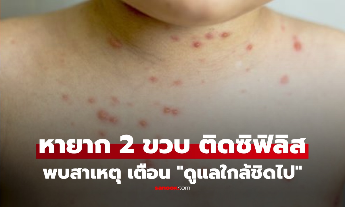 อึ้ง 2 ขวบ ติดเชื้อ \